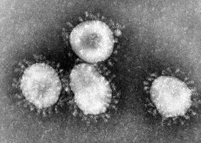 Coronaviruses are a group of viruses that have a halo, or crown-like (corona) appearance when viewed under an electron microscope./ Public Domain